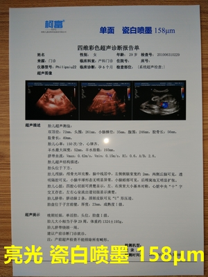 三次元CTスキャン フィルム125ミクロンの白い基礎不透明なインクジェット医学のフィルム
