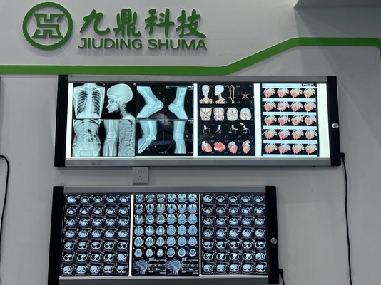 印刷 青色熱X線レーザーフィルム 医療X線機器