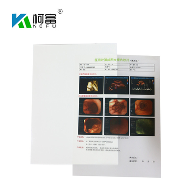 白いインクジェットX光線のフィルムA4 B5 16Kのインクジェット プリント用フィルム125ミクロンの