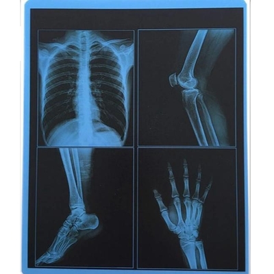 35x43CM 青い医療用X線フィルム CT MRI 画像用