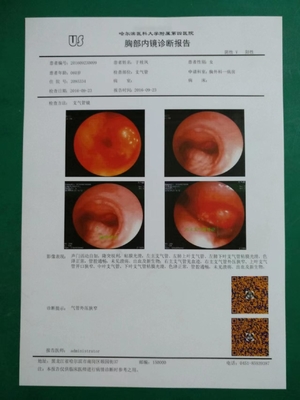 ペットによって基づく125um 150um 180umの医学の乾燥したフィルムの白人のインクジェットX光線のフィルムOEM