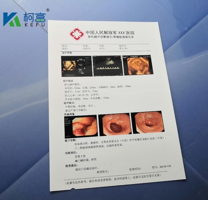 白く不透明なペット フィルム125ミクロンは医学レーザーのフィルムA4 B5 16Kを広げる