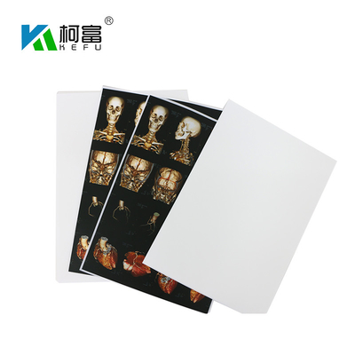 青く白い基盤富士プリンターのための医学X光線のフィルム35x43CMの10x12インチX光線の乾燥したフィルム