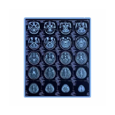 320dpi決断の医学の乾燥したフィルム10x12のインチ ペットはサーマル プリンターのフィルムを基づかせていた