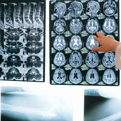 インクジェットブルー 医療用ドライフィルム 透明ブルーX線フィルム CT DR MRI 放射線装置