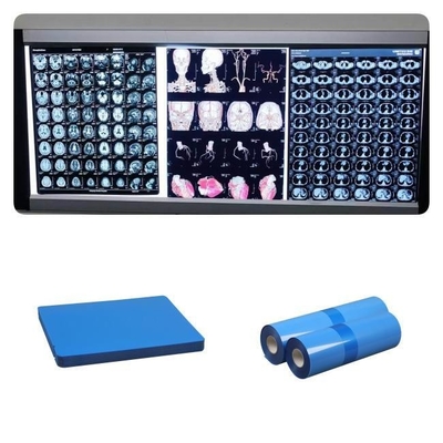 DR CT MRIの医学のインクジェットX光線は青い基礎インク8x10 A4 A3 10inchロール210ミクロンの撮影する