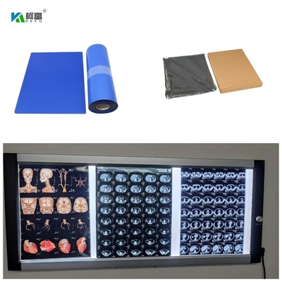 青い基礎乾燥したインクジェット医学X光線のフィルムDR CT MRIの染料インク8x10 A4 A3 100は広がる