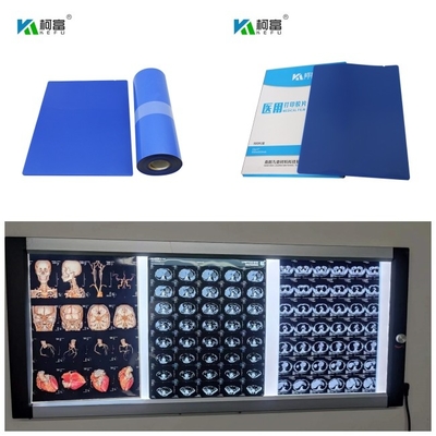医学の青い基礎インクジェットX光線のフィルムDR CT MRIの染料インク14inch Xは125枚のシート10x12を転がす