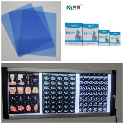 青い基礎医学のインクジェット乾燥したフィルムDR CT MRI X光線ロール210ミクロンの8x10 A4 A3 14inch