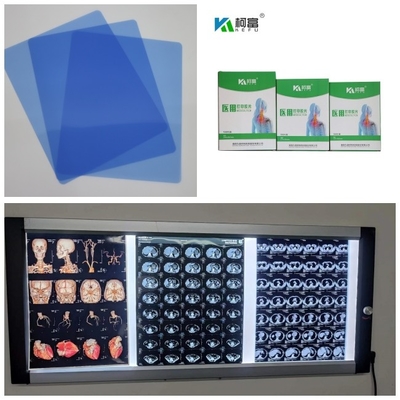 DR CT MRIの医学のインクジェットX光線は青い基礎インク8x10 A4 A3 10inchロール210ミクロンの撮影する