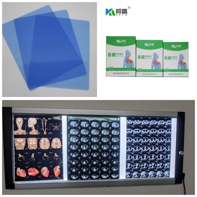 出力280gsm DR CT MRIのイメージ10x12 11x14 A4 A3のための医学X光線のフィルムのインクジェット青い基盤