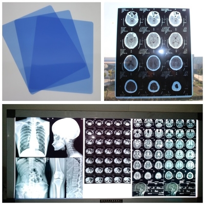 210umインクジェット シート8x10が付いているデジタルDR CT MRIカセットのための医学X光線のフィルムの青