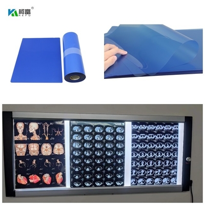 210micronsインクジェットCT DR MRIおよび3D CT MRIのイメージのための医学X光線のフィルムは14x17を出力した