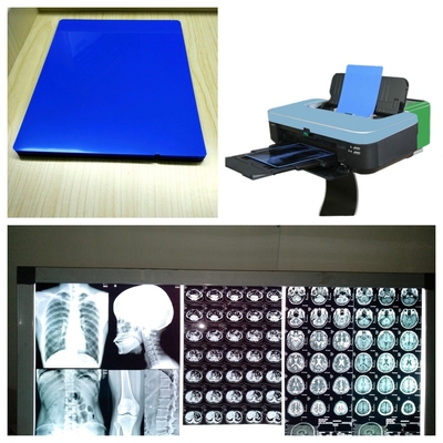 インクジェットX線フィルムシート 8x10 10x12 11x14 14x17 A4 A3 A3+ 13X17 印刷速度 1-3 分