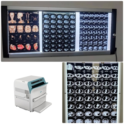 医療用高解像度X線ドライフィルム 10x12 DR CT MRI DSA画像出力 富士プリンタと互換性