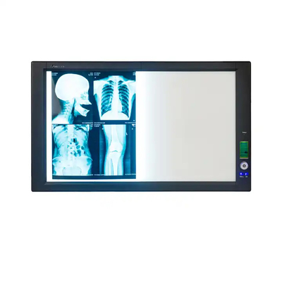 医療用X線フィルム プリンター用乾燥熱