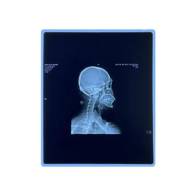 医療用X線 乾燥フィルム 医療用X線 インクジェットフィルム 明確な画像品質