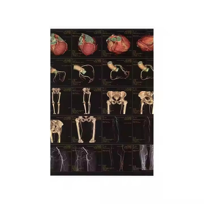 医療用X線 乾燥フィルム 医療用X線 インクジェットフィルム 明確な画像品質