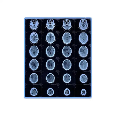 医療用X線フィルム プリンター用乾燥熱