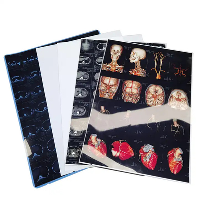 インクジェット医療用ドライフィルム 透明ブルーX線フィルム CT DR MRI 放射線装置