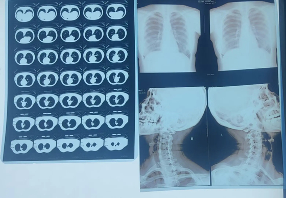 医療画像システム レーザーX線 乾燥フィルム DR CR MRI X線プリンター