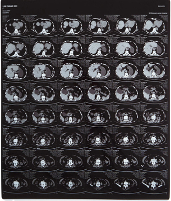 青色 10X12 インチ インクジェット ペット医療X線フィルム/画像