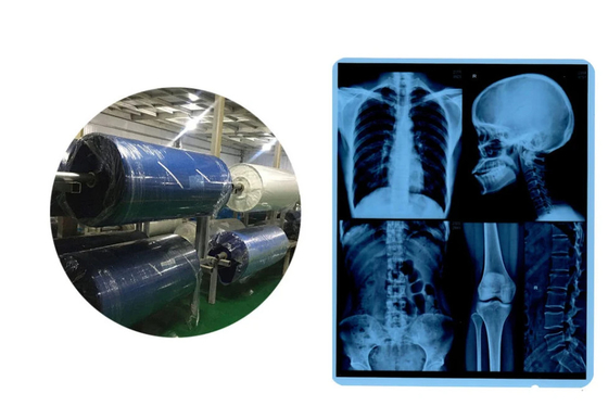 医療用X線フィルムロール インクジェットブルーベース CR DR CT MRI 画像出力