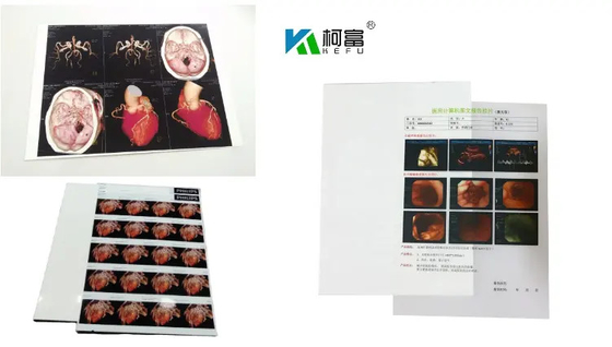 204±8 μM厚さ 耐久性高 ≤20% 霧 UV抵抗性