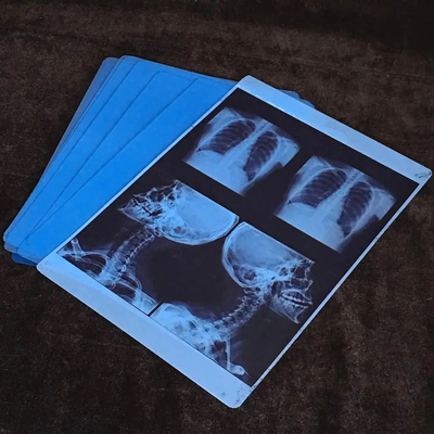 8x10インチ 100枚/パック 10パック/箱 インクジェット印刷のための熱フィルム サイズパッケージ