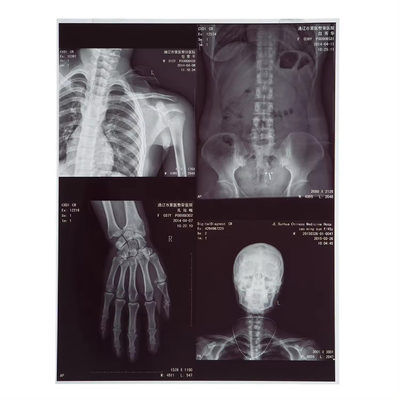 210 マイクロンX線フィルム 医学インクジェットレーザー CT Dr Mr