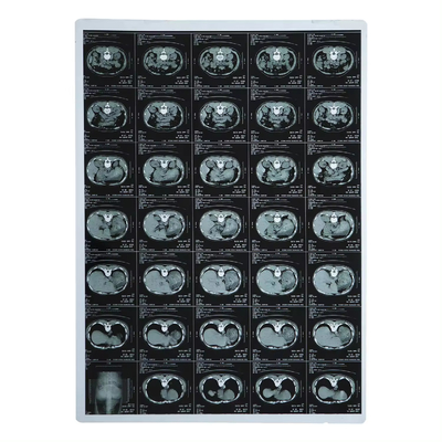 210 マイクロンX線フィルム 医学インクジェットレーザー CT Dr Mr