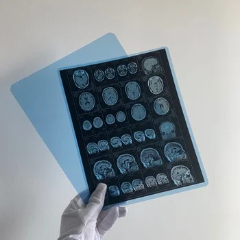 医療用X線ドライフィルム 医療用X線インクジェットフィルム