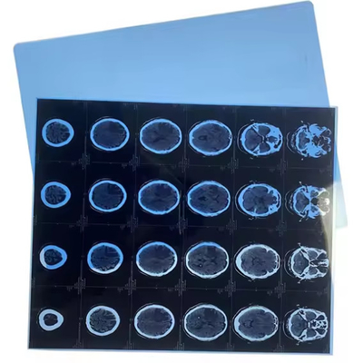 医療用X線フィルムロール インクジェットブルーベース CR DR CT MRI 画像出力