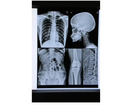 青いインクジェット医療X線フィルム 医療乾燥フィルム A4シートまたはロール まだレビューはありません