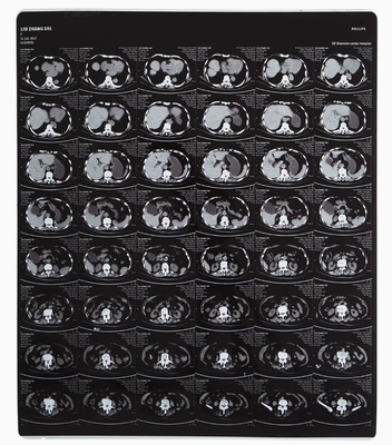 優れた柔軟性 レーザー画像プリンタープロセッサのための医療X線フィルム
