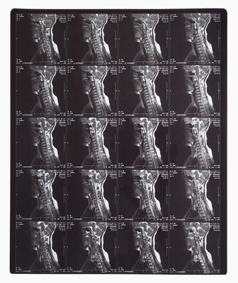 熱印刷レーザー画像プリンタのための青色放射線画像レーザーフィルム
