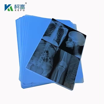 高品質の医療用X線 ブーレとグリーンフィルム 8*10in\20*25cm