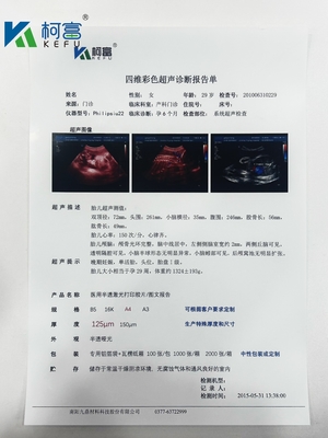 インクジェット透明医療用ドライフィルム 白いX線フィルム CT DR MRI 放射線装置