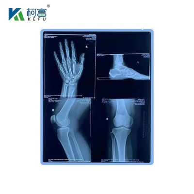 200±5μM 厚さ 医療用X線乾燥フィルム 児童病 心臓病科