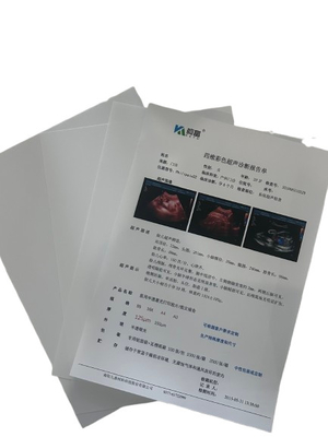 精密で詳細な診断結果のために,0.28DX線フィルム