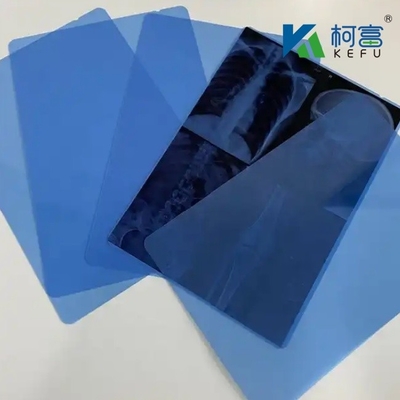 200±5μmのX線フィルム 明確で正確な医療解釈のために