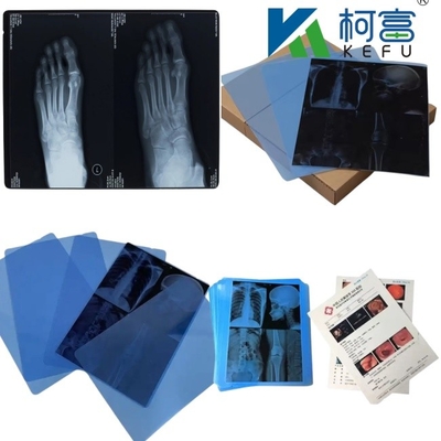 14*17 インチ 医療用X線/CT/DRドライスキャンフィルム X線レーザー画像プリンターおよび熱画像プリンター機器