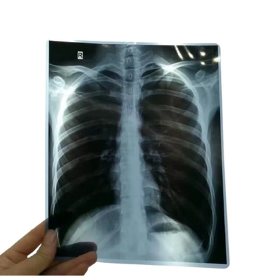 14*17 インチ 医療用X線/CT/DRドライスキャンフィルム X線レーザー画像プリンターおよび熱画像プリンター機器