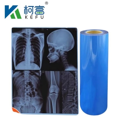 防水医療用X線熱フィルム インクジェットプリンター用X線ブルーフィルム