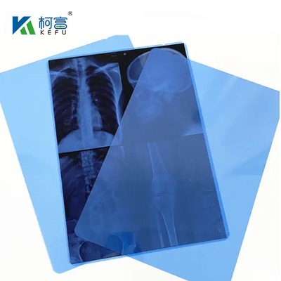10*12インチ 医療用X線/CT/DRドライスキャンフィルム X線レーザー画像プリンターおよび熱画像プリンター機器