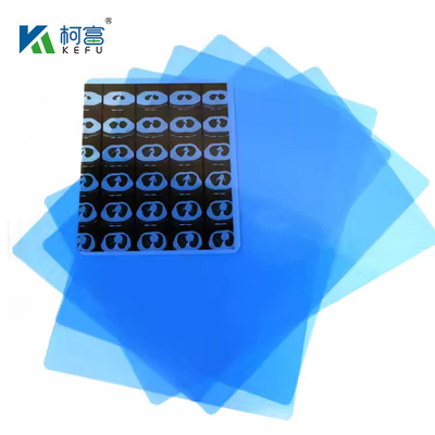14*17インチ 医療用X線/CT/DRドライスキャンフィルム X線レーザー画像プリンターおよび熱画像プリンター機器