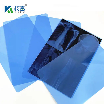 14*17インチ 医療用X線/CT/DRドライスキャンフィルム X線レーザー画像プリンターおよび熱画像プリンター機器