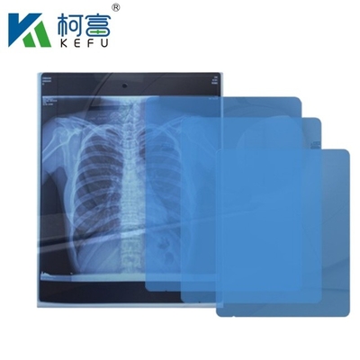 高画質の医療画像 CT DR インクジェット医療X線ペットフィルム 175mic 215mic 透明ブループリントフィルム