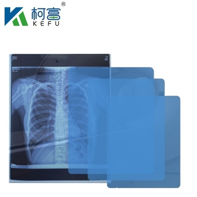 医療用X線/CT/DRドライスキャンフィルム X線レーザー画像プリンターおよび熱画像プリンター機器