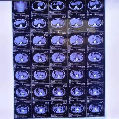 合理的な費用 高度な画像安定性を持つ医療用X線フィルム 明確で正確な医療診断画像を提供する